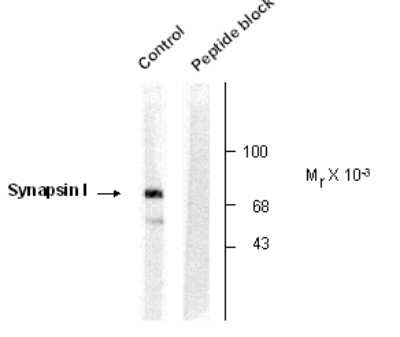 Western Blot: Synapsin I [p Ser9] Antibody [NB300-180]